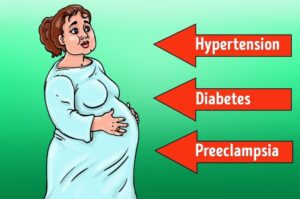OBESITY DURING PREGNANCY 